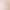 Gauze Maternal Postpartum Abdominal Belt Waistband Four-Season Pure Cotton Breathable Shaved Caesarean Section Pregnant Women's Abdominal Belt Manufacturer