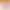 Free Shipping Bra without Steel Ring Two-in-One False Breast Lightweight Silicone Breast for Women after Thickened Underarm Surgery