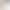 Acrylic Tortoiseshell Amber Two-Tone Anti-Loss Thick Glasses Chain with Anti-Slip and Anti-Loss Design Acrylic Tortoiseshell Amber Two-Tone Anti-Loss Thick Glasses Chain with Anti-Slip and Anti-Loss Design