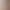 Maternity dress autumn and winter New loose plus size V-neck bottoming skirt sweater dress over the knee long breastfeeding dress Maternity dress autumn and winter New loose plus size V-neck bottoming skirt sweater dress over the knee long breastfeeding dress