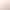 Breast Care Day Cares for Women's Health and Prevents Breast Cancer. Hand-Woven Bracelets, Bracelets, Personalized Hot-Selling Products in Stock