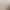 Bidet Foldableing Squat-Free Gynecological Confinement Basin Pregnant Women Wash Basin Ass Washing Soaking Medicine Basin Anal Intestine Postoperative Care Basin