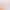 Yoga Resistance Band for Shoulder Opening and Back Beauty, Home Fitness Women's Elastic Band Figure-Eight Rope Stretching Tool