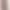 Gentle Style Lace Embroidered Dress, New Style for Women, Autumn and Winter, Fleece-Lined and Thickened, French-Style Elegant Inner Long Dress with Mesh Gentle Style Lace Embroidered Dress, New Style for Women, Autumn and Winter, Fleece-Lined and Thickened, French-Style Elegant Inner Long Dress with Mesh