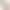 [National 3C Certification] 2026 New Model Power Bank with Built-In Cable, 20000Mah Super Fast Charging, Ultra-Thin and Compact