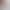 1.56 Free Curved Surface Adjustment of Eye Pressure Triangular Prism, Progressive, Anti-radiation, Anti-blue Light, Gray-changing Tea, Far and Near Dual-use 1.56 Free Curved Surface Adjustment of Eye Pressure Triangular Prism, Progressive, Anti-radiation, Anti-blue Light, Gray-changing Tea, Far and Near Dual-use