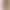Cross-border Color-matching Naked Sports Underwear Quick-drying Shockproof Yoga Vest-style Bra Removable Chest Pad Fitness Suit