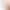 Directly from the Manufacturer: Nose Clip, Nose Bridge, Nose Seam, Comprehensive Nose Enhancement, Nose Seam and Nasal Base Bone Shaping Device, Beauty Tool