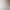 Cross-border portable wireless auxiliary light therapy device for chronic rhinitis, alleviates allergic nasal congestion, runny nose, and itchy nose, infrared light therapy device