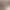 Women's Hairpiece for Top of Head, Realistic Human Hair to Cover Gray Hair, 3D French Bangs, Natural and Fluffy, Lightweight and Seamless Women's Hairpiece for Top of Head, Realistic Human Hair to Cover Gray Hair, 3D French Bangs, Natural and Fluffy, Lightweight and Seamless