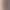 Summer New Dopamine-Style Loose Casual Shorts with Elastic Waist, Vintage Artistic Five-Point Pants with Design Buttons for Women Summer New Dopamine-Style Loose Casual Shorts with Elastic Waist, Vintage Artistic Five-Point Pants with Design Buttons for Women