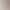 2026 real-shot autumn and winter new model, slimming and stylish maternity plus-size tank dress set 2026 real-shot autumn and winter new model, slimming and stylish maternity plus-size tank dress set